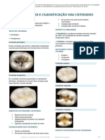 Nomenclatura e Classificação Das Cavidades - Passei Direto