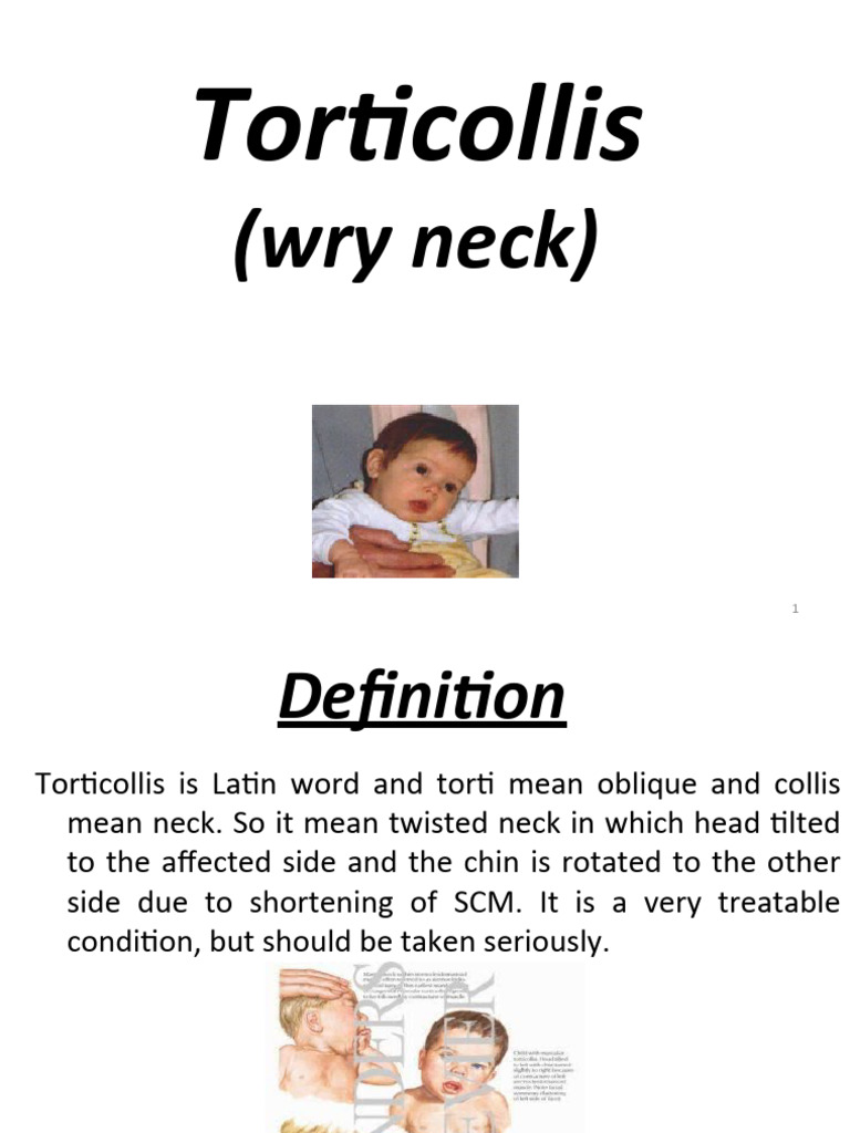 Understanding Torticollis: Causes & Treatment | PDF | Musculoskeletal ...