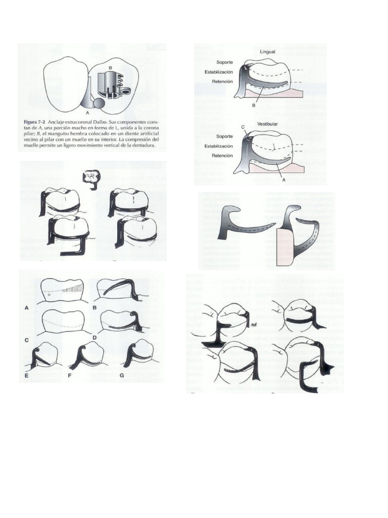 Retenedores pdf