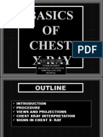 Basics of Chest Xrays DR Divya 2