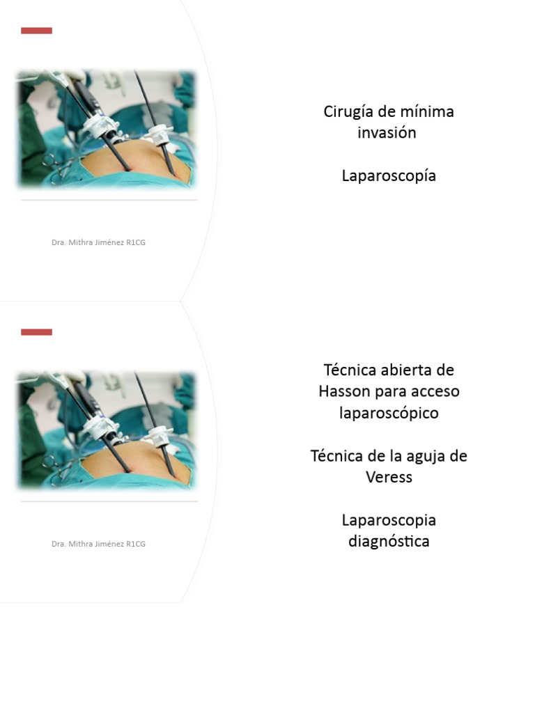 Técnica de Hasson en Laparoscopía | PDF | Medicina CLINICA