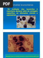 Anomalias Leucocitárias