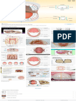 Searchq Mesial+y+distal&tbm Isch&ved 2ahUKEwi3uvTTi4 3AhWCOLkGHUSdDvwQ2-cCegQIABAC&oq Mesi&gs LCP ChJtb2