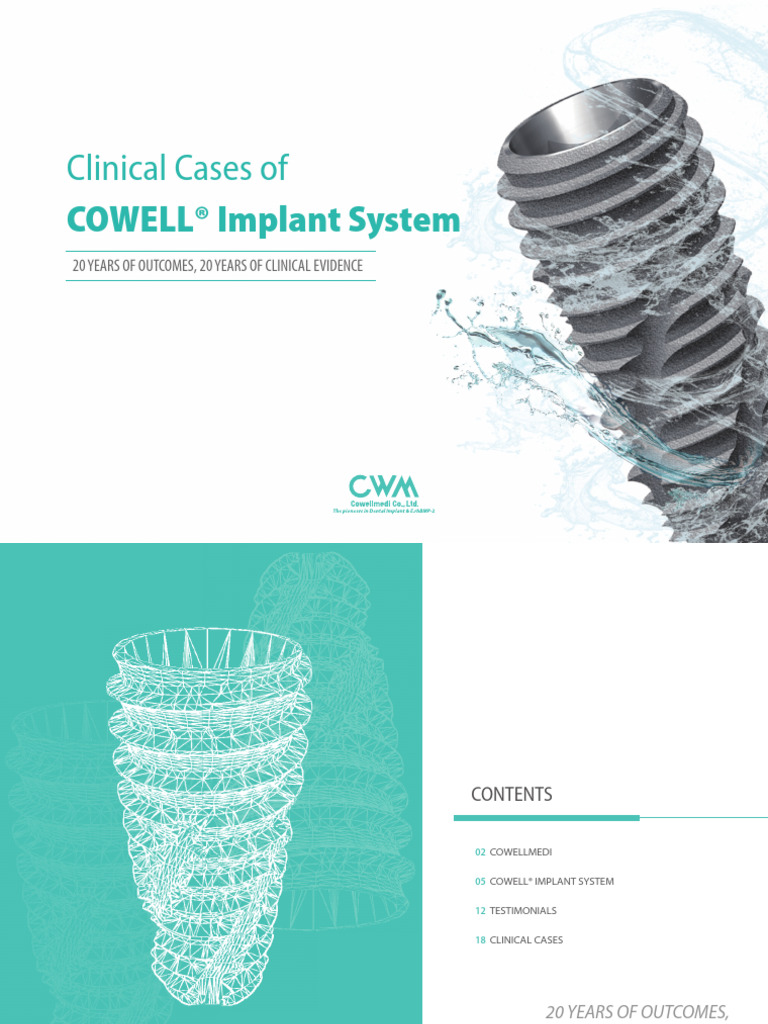 Clinical Cases of COWELL Implant System | PDF | Dental Implant | Dental ...