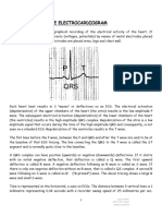 Electrocardiogram Notes