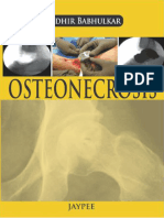 Osteo Necrosis