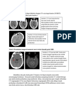 Gambaran Radiologis