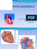 Cardiopatía Isquémica