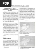 Download cornelia de lange by Romina Fracei Olate SN72846299 doc pdf