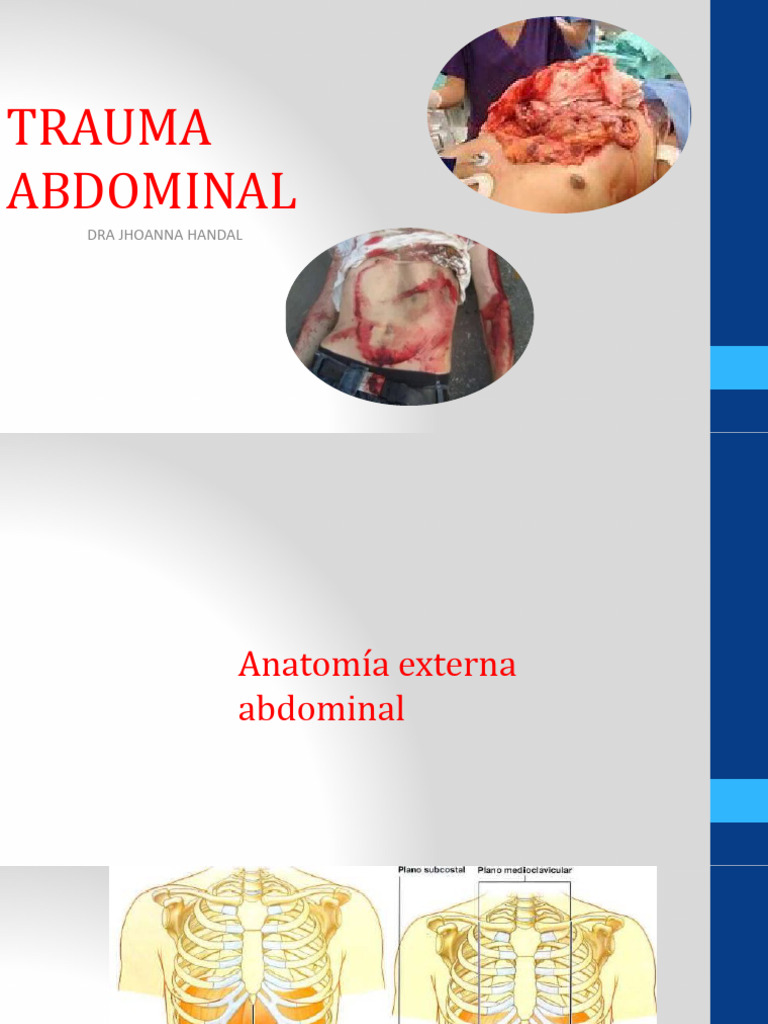 Tema 9 - Trauma Abdominal | Descargar gratis PDF | Abdomen | Intestino ...