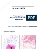 Citologia Cervical Adenocarcinoma e Carcinogênese Profa Samira