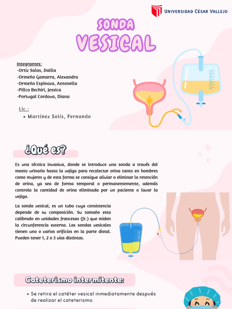 Calibre y uso de sonda vesical | PDF | Sistema genitourinario ...