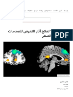 الذكاء الاصطناعي يساعد في خلق - أمل جديد - لعلاج الصدمات النفسية في مرحلة الطفولة - BBC News عربي