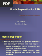 Mouth Preparation For Removable Partial Denture March 2020