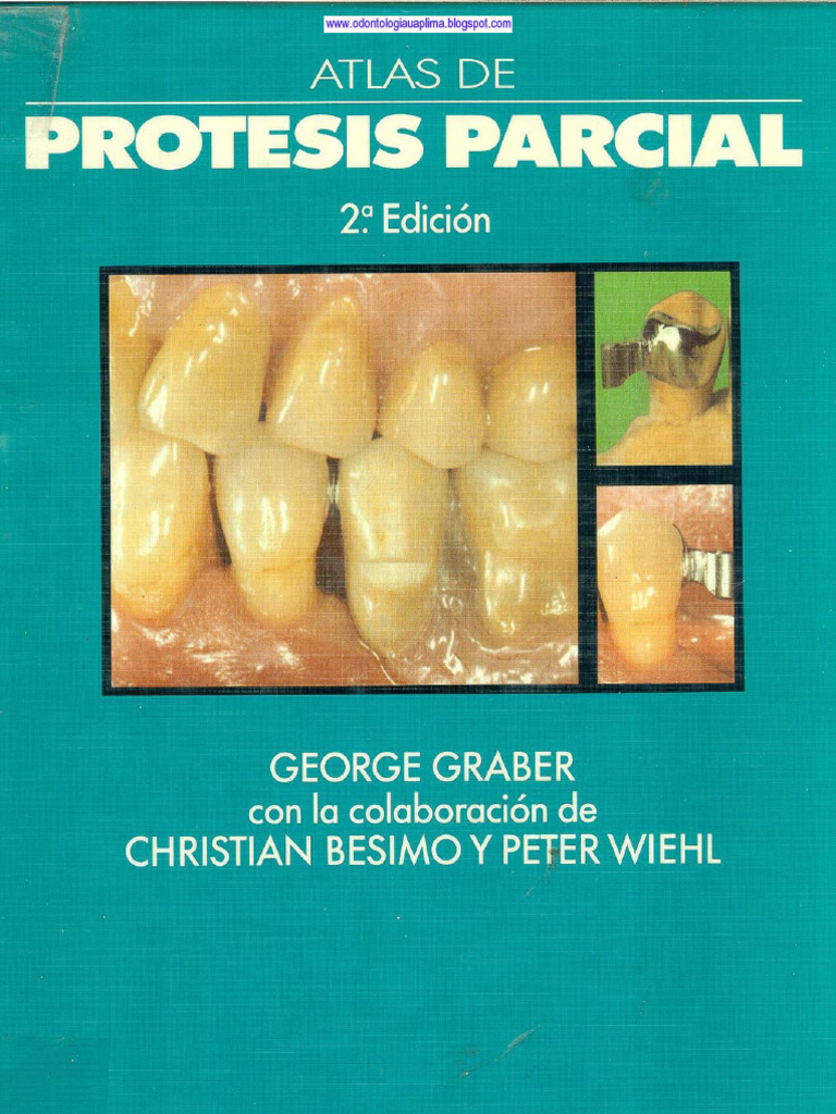 Atlas de Protesis Parcial | PDF