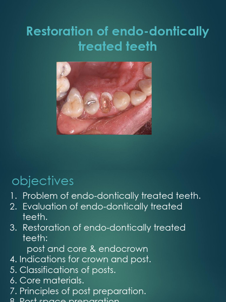 Restoring Endodontically Treated Teeth | PDF | Human Tooth | Tooth