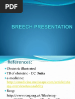 Download Breech Presentation by Shuhada Wahab SN72902150 doc pdf