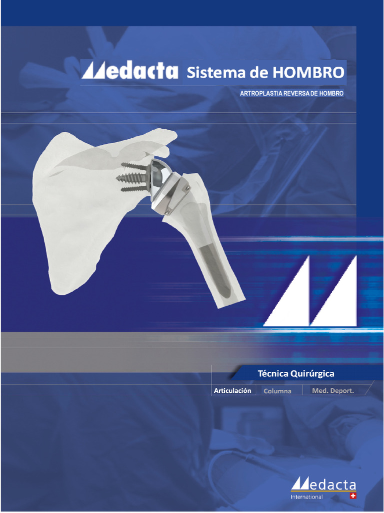 Artroplastia Total Reversa del Hombro | PDF | Hombro | Tornillo