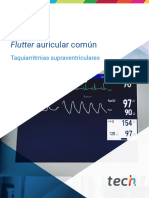 Flutter auricular común M3 T8