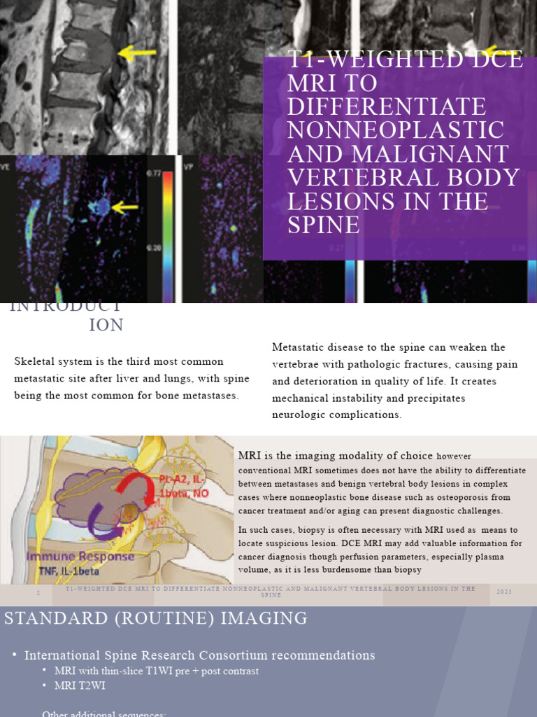 DCE MRI for Differentiating Spinal Lesions | PDF | Magnetic Resonance ...