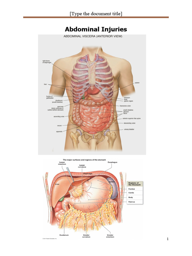 Abdominal Injuries 3 | PDF | Major Trauma | Medical Specialties