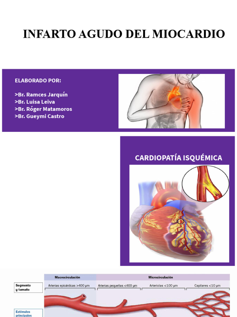 Copia de IAM | PDF | Stent | Infarto de miocardio