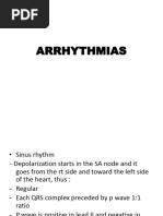 Arrhythmias