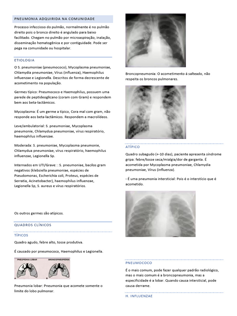 Pneumonia Adquirida Na Comunidade | Download grátis PDF | Pneumonia ...