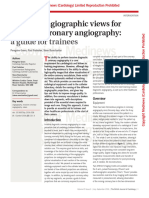 Angiographic views for coronary angiography