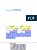 1-Fracture Definition and Classification