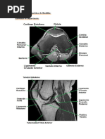 Radiografía de Rótula: Técnicas y Posicionamiento | PDF | Rodilla ...