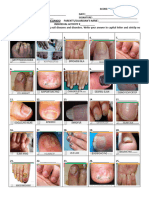 ACTIVITY IN Nail Diseases and Disorders