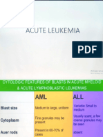 Acute Leukemia (ALL)