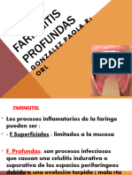 Faringitis Profundas Pao