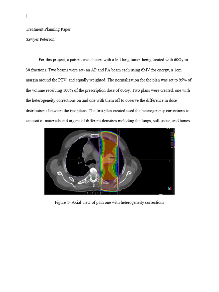 Lung Tumor Treatment Planning Analysis | PDF | Absorbed Dose | Ct Scan