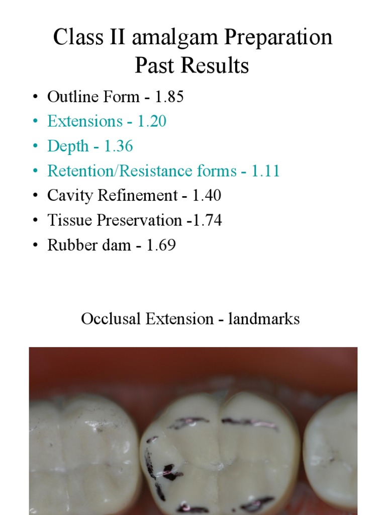 02 Class II Amalgams Examples) PDF
