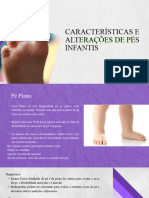 Características e Alterações de Pés Infantis