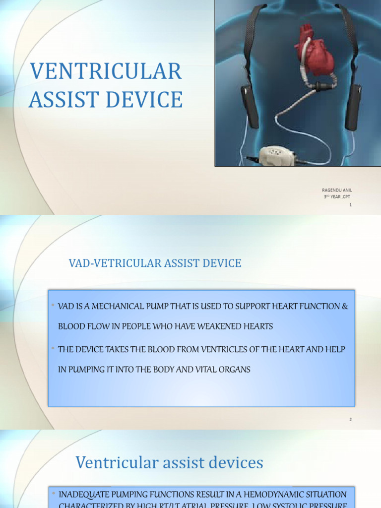 Ventricular Assist Device | PDF | Heart | Ventricle (Heart)