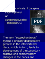 Osteochondrosis of The Spine