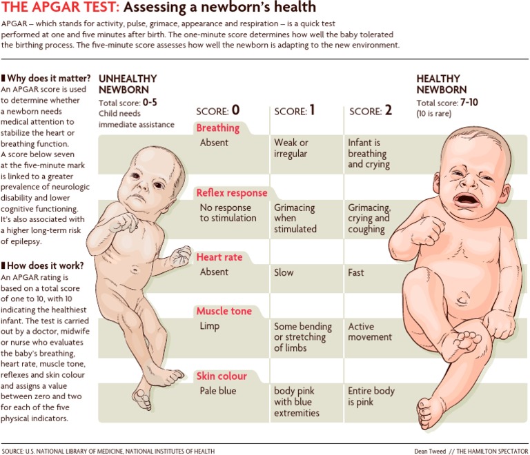 Understanding the APGAR Test for Newborns | PDF