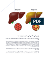 Fatty Liver