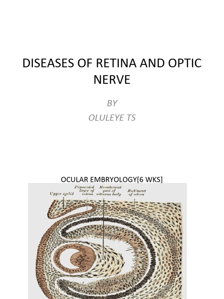 RETINA AND OPTIC NERVE DX | PDF | Retina | Human Eye