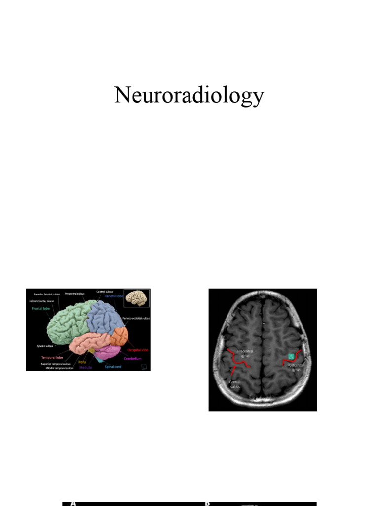 Neuroradiology: Normal Variants & fMRI | PDF | Science & Mathematics ...
