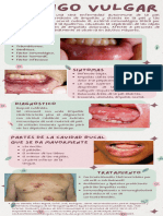 Estomatitis Aftosa R