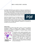 Leucemia Mieloide aguda-PI