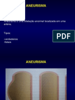 Aneurism A