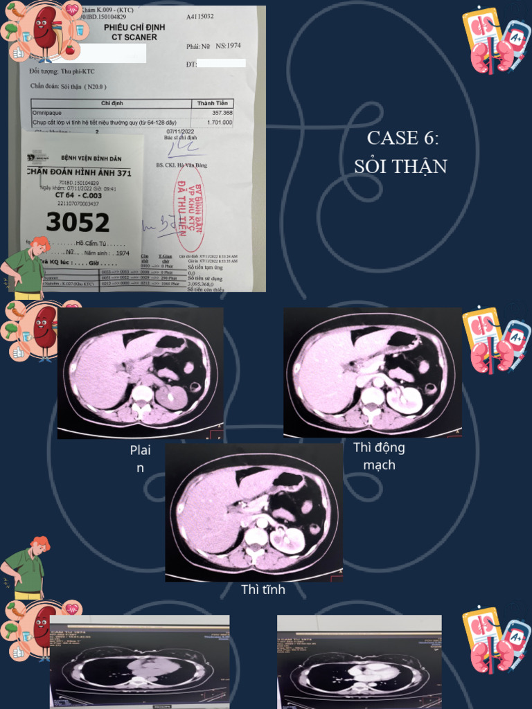 Ân CT 3 | PDF