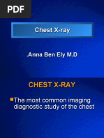Download Chest X-Ray Anna Americans by api-26159412 SN7317904 doc pdf