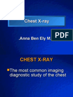 Chest X-Ray Anna Americans