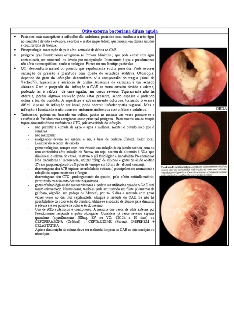Otite Externa | PDF | Infecção | Especialidades médicas